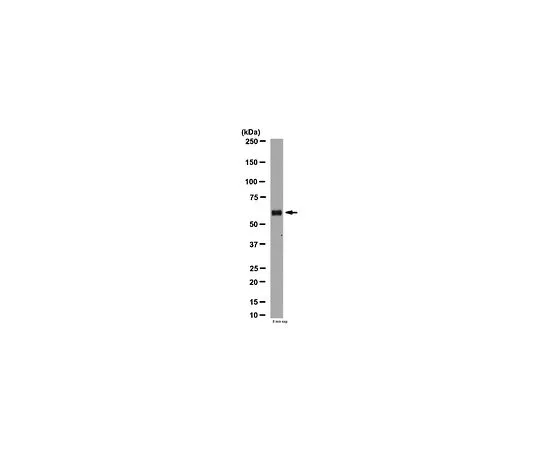 62-8465-32　抗芳香酶;100μg　ABN30