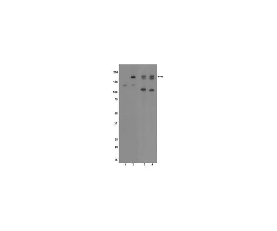 62-8386-42　抗磷VEGFR2/Flk-1/KDR (Tyr1054);100μg　07-722