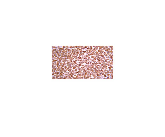 62-8374-94　抗人酪蛋白激酶2α，1AD9;100μg　05-1431