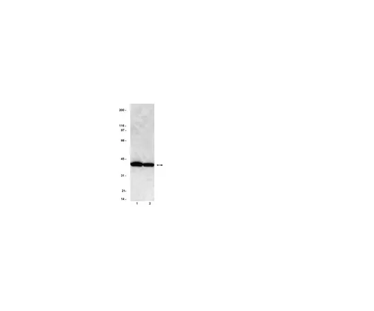 62-8371-11　抗PP2A, C亚基，克隆1D6;200μg　05-421