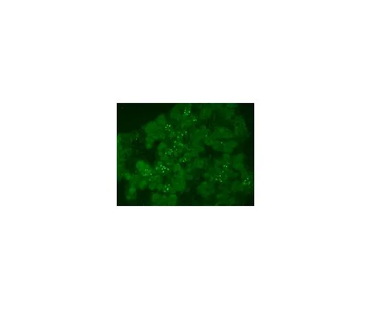 62-8454-58　抗神经肽-3 (兔多克隆);100μl　AB10535
