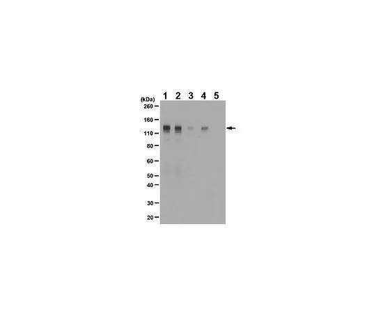 62-8383-48　抗磷FGFR-1 (Tyr653/Tyr654);100μg　06-1433