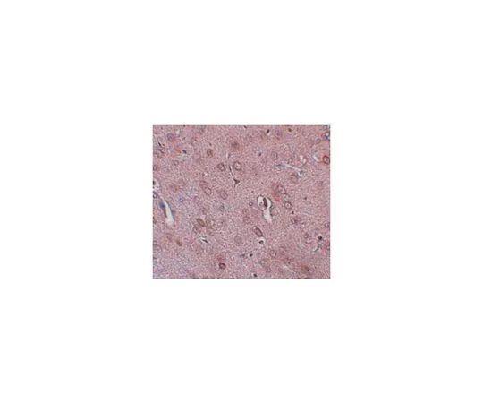 62-8467-81　反TRES　ABN648