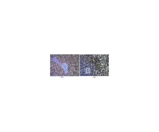 62-8383-02　抗白细胞介素18 (IL-18);100μg　06-1115