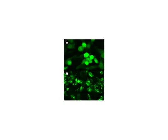 62-8394-43　慢Brite (TM) GFP-LC3慢病毒生物传感器　17-10193