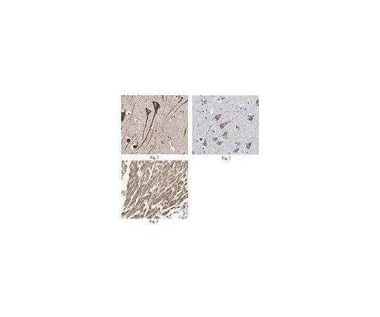 62-8466-24　抗PTGDS抗体猫。不，是ABN253　ABN253