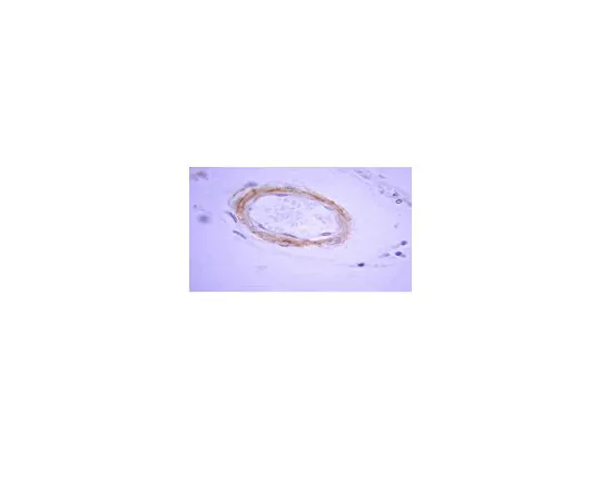 62-8449-14　抗β-淀粉样蛋白1-42;50μg　AB5078P