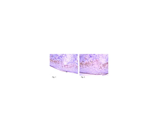 62-8374-27　抗哈马汀 (TSC1);100μL　05-1113