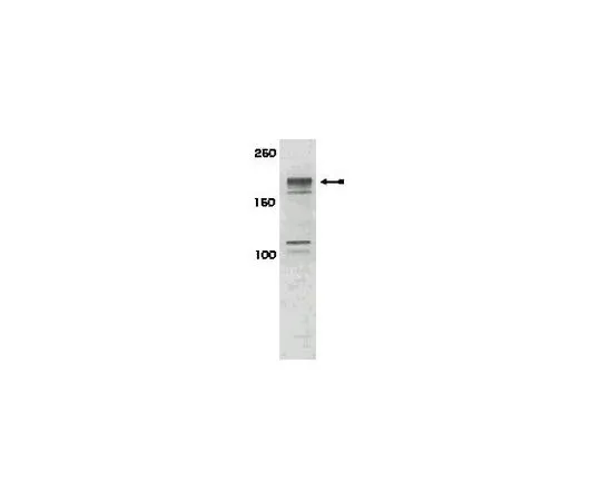 62-8386-80　抗磷IRS1 (Ser616);100μL　07-843