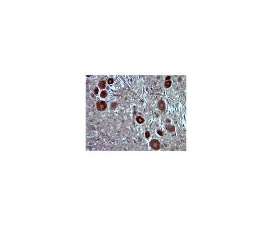 62-8465-35　抗PDE11A;100μg　ABN34