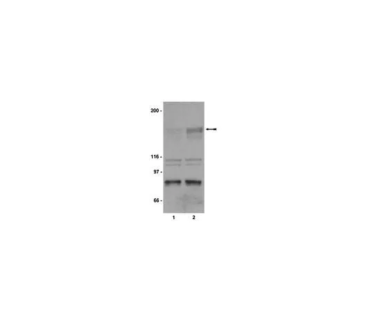 62-8384-71　抗磷KDR/Flk-1/VEGFR2 (Tyr1214);200μg　07-374