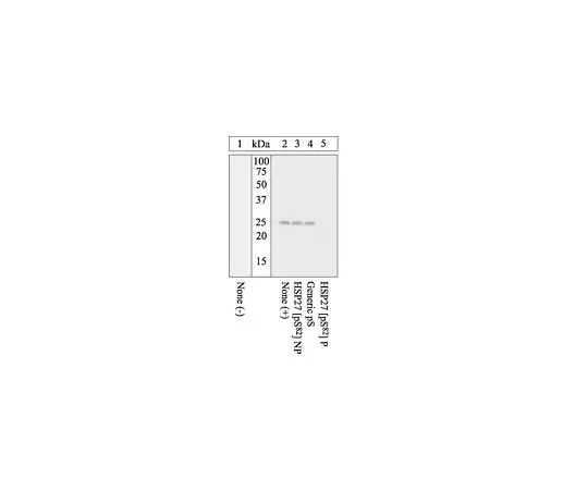 62-8448-11　抗磷HSP27 (pS82);100μL　AB3561