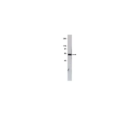 62-8381-29　抗GST标记;200μg　06-332