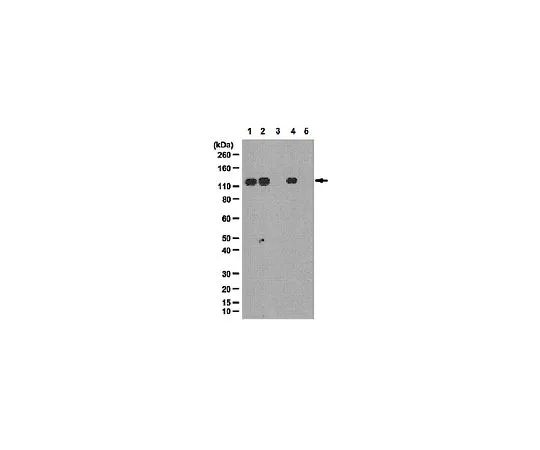 62-8388-40　抗磷SRPK2 (Ser494);100μg　07-1817