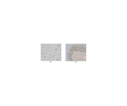 62-8466-21　抗GluR1抗体猫。不，是ABN241　ABN241