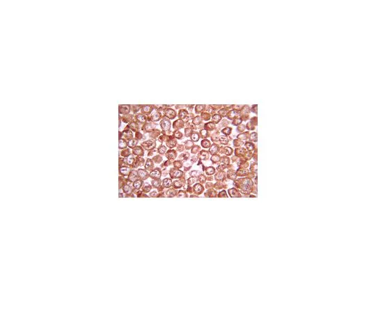62-8387-63　抗糖原合成酶激酶-3β (GSK3β) ，a.a。335-349;50μg　07-1413