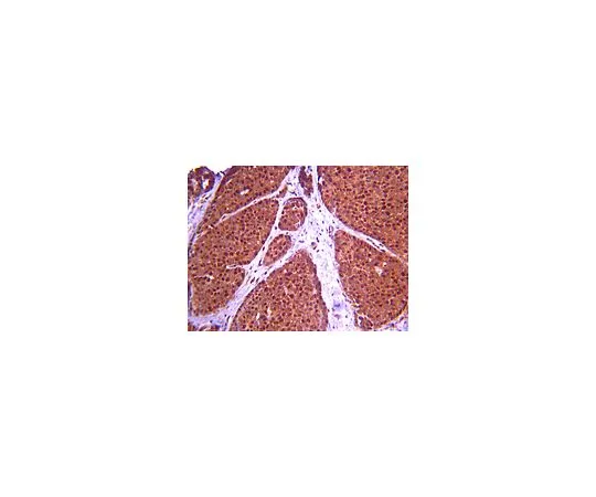 62-8389-20　反ASPM;100μg　09-066