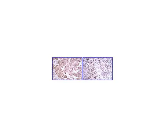 62-8387-69　抗PDGF-BB;100μL　07-1437