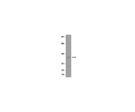 62-8385-43　抗p40-phoon;200μg　07-503