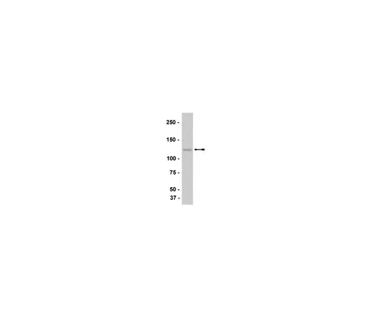 62-8373-41　抗M钙粘蛋白，克隆12G4;100μg　05-852