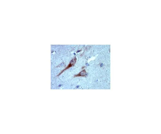 62-8465-38　抗RAB35;100μg　ABN38