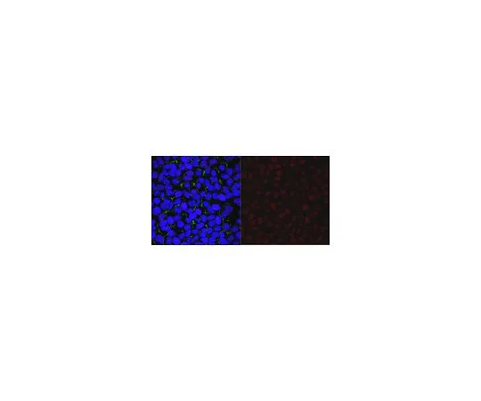 62-8462-90　抗ALKBH5抗体　ABE1013-I