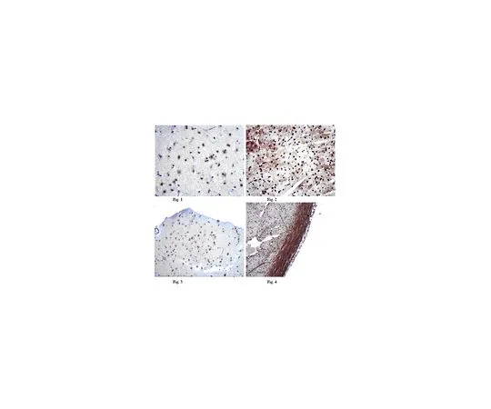 62-8456-47　抗米托芬-2 (Mfn2);100μg　ABC42