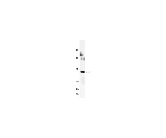 62-8382-50　反GADS;200μg　06-983