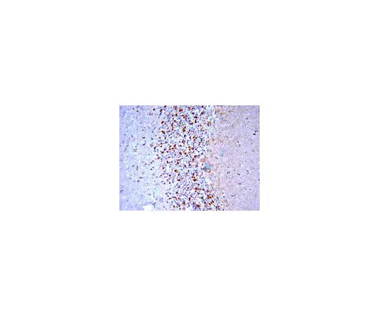 62-8452-03　反BACE, C末端;100μg　AB5940