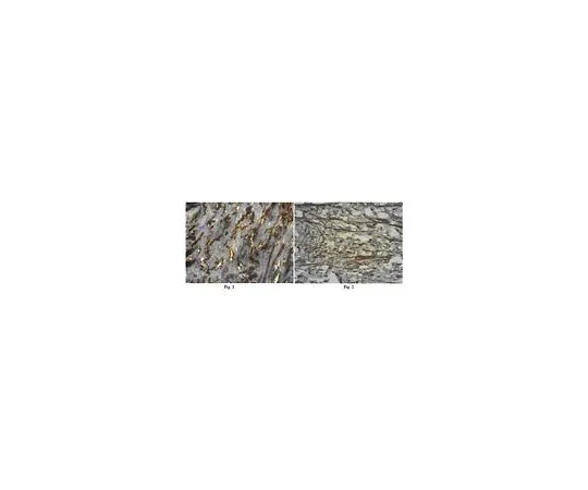 62-8447-01　抗整合素β-3;100μg　AB2984
