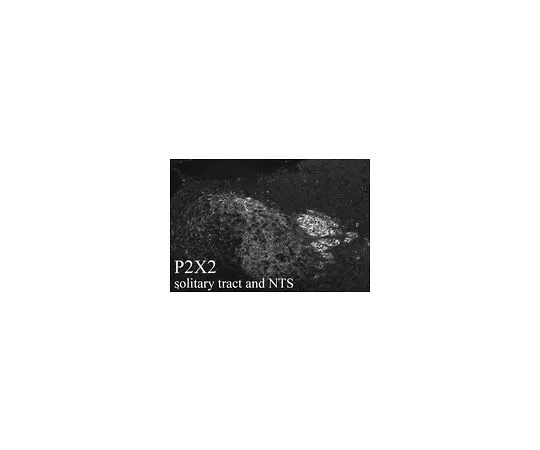 62-8451-85　反P2X2接收器;50μL　AB5894