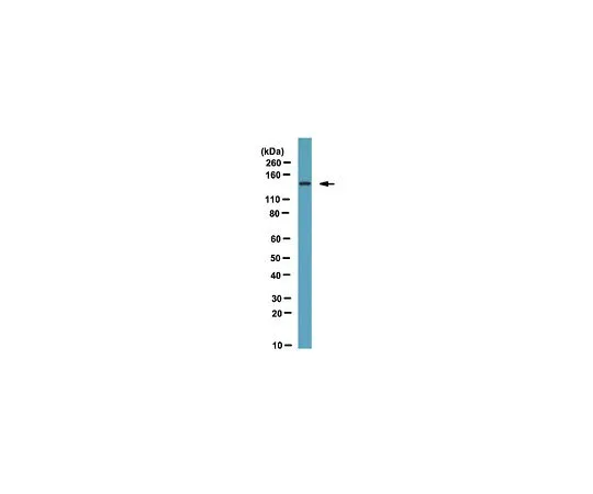 62-8469-13　抗FHOD1;100μg　ABS53