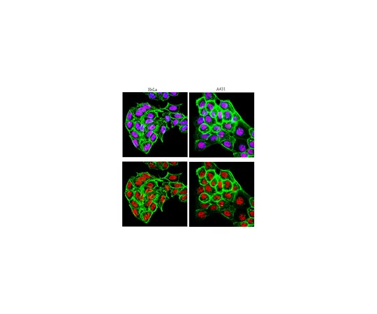 62-8369-36　抗RARα，克隆9α-9A6;100μL　04-1545