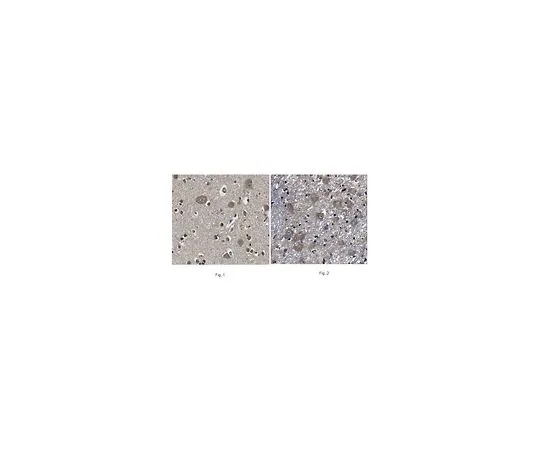 62-8467-22　抗淀粉样蛋白1　ABN444