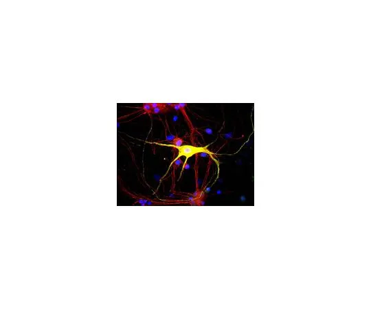 62-8452-88　抗外围素;50μL　AB9282