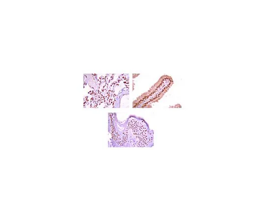 62-8381-54　抗Na++K+ATP酶α-1;100μg　06-520