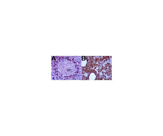 62-8373-89　抗TCL1;100μL　05-954