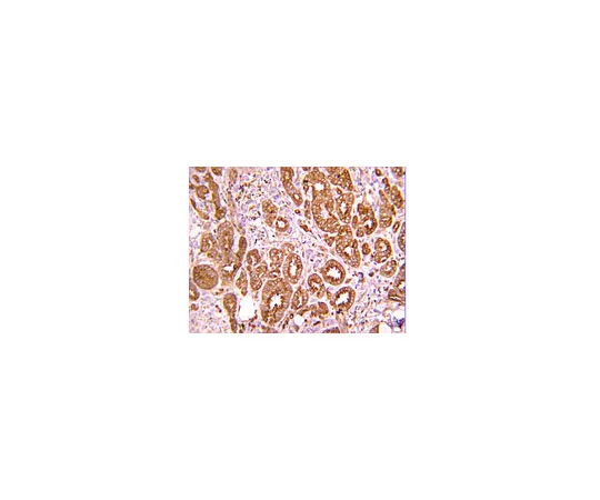 62-8374-03　抗Met (细胞外) ，克隆4F8.2;100μg　05-1049