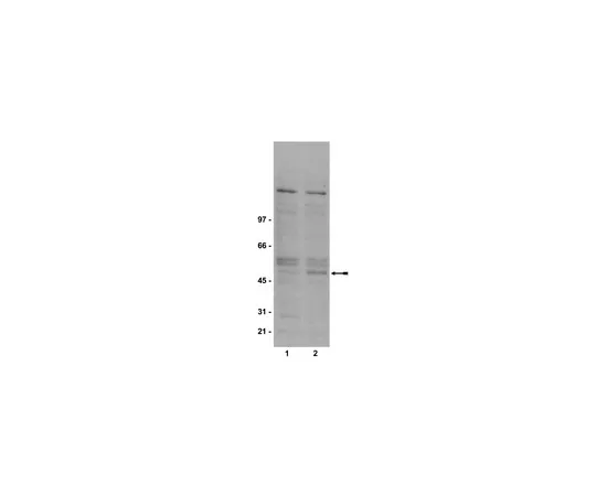 62-8372-18　抗磷GSK3β (Ser9) ，克隆2D3;100μg　05-643