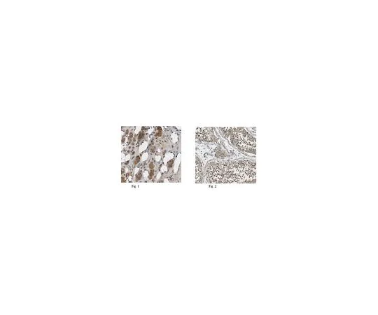 62-8444-21　抗PNMT抗体　AB110-I