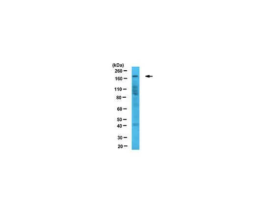 62-8463-19　反JARID1C　ABE1082