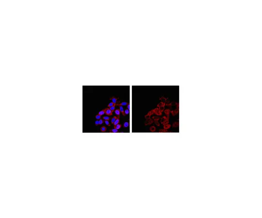 62-8367-59　RIPAb+ (TM) SMN;10次检测　03-200