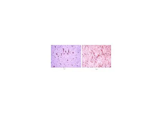 62-8454-67　抗mGluR8;100μL　AB10556