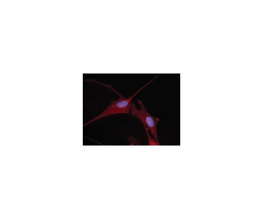 62-8451-31　反Nkx-5.1;100μg　AB5744