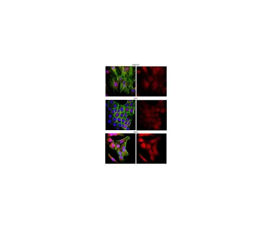 62-8452-30　抗胸腺素β-4;100μg　AB6019