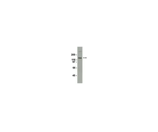 62-8385-93　抗mGluR1;200μg　07-617