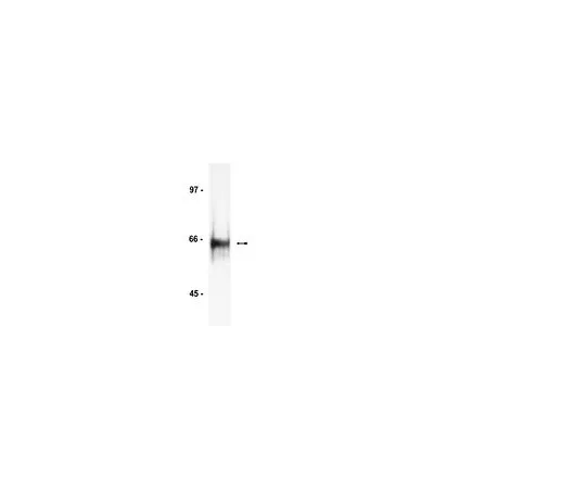 62-8381-96　抗HDAC1;200μg　06-720
