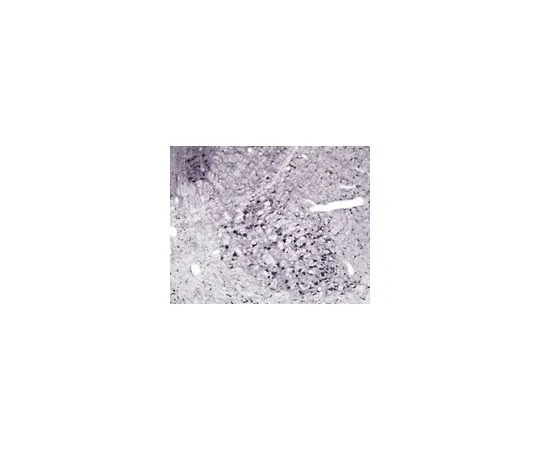 62-8445-58　抗一氧化氮合酶I;100μg　AB1632