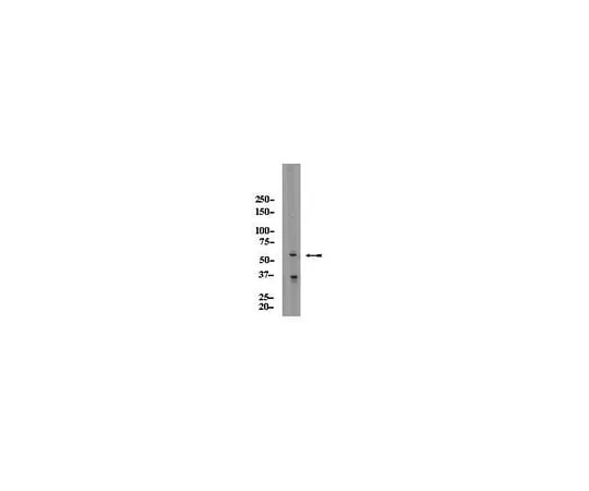 62-8389-75　抗AIR;100μg　09-456