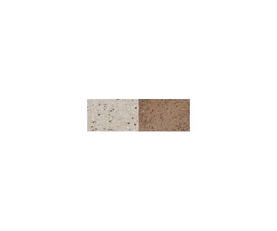62-8465-37　反Home1;100μg　ABN37